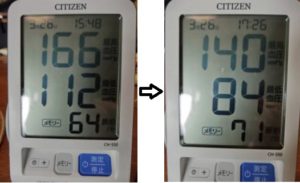 高血圧とアーシング